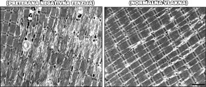 kidanje-ostecenje-misica